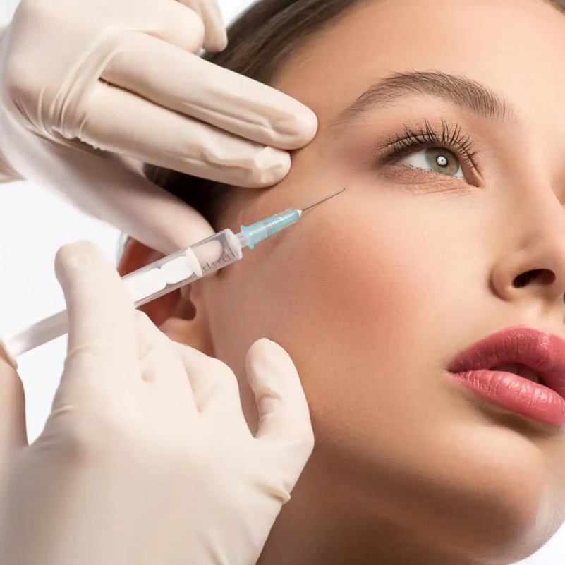 3 filler juvederm 1ml