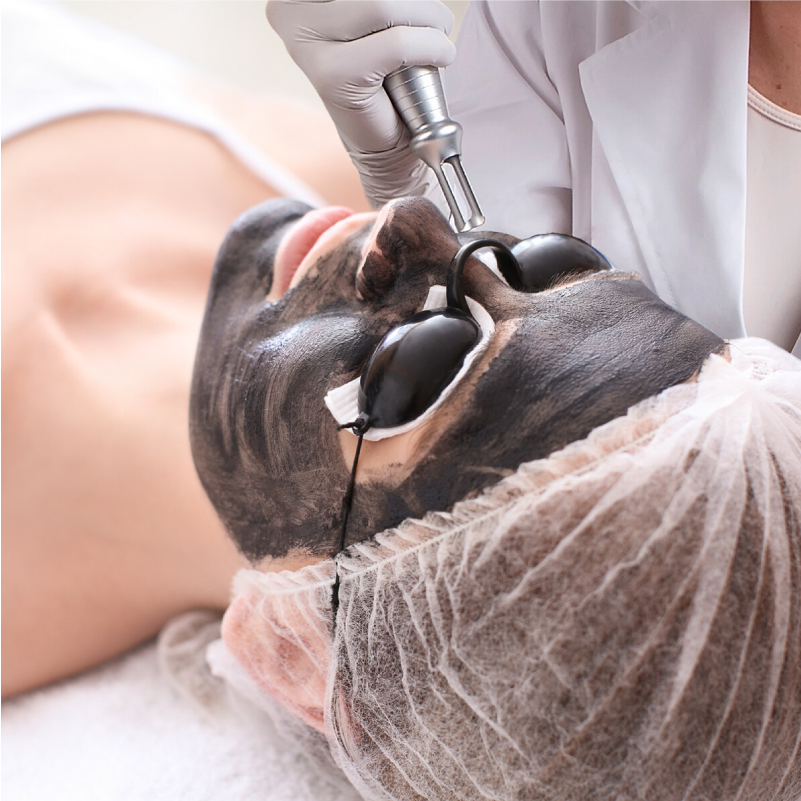 tratamientos cosmetológicos y aparatología 4 hollywood lÁser peel