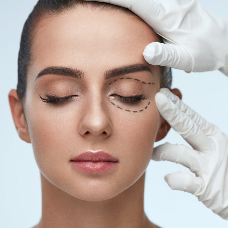 tratamientos cosmetológicos y aparatología 5 blefaroplastia sin cirugÍa